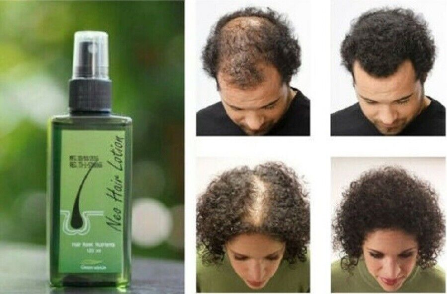 Authentic Thailand Neo Hair Lotion 120ml/ Neo Hair Shampoo 160ml/ Wiss Hair Tonic 100ml SG Ready Stock