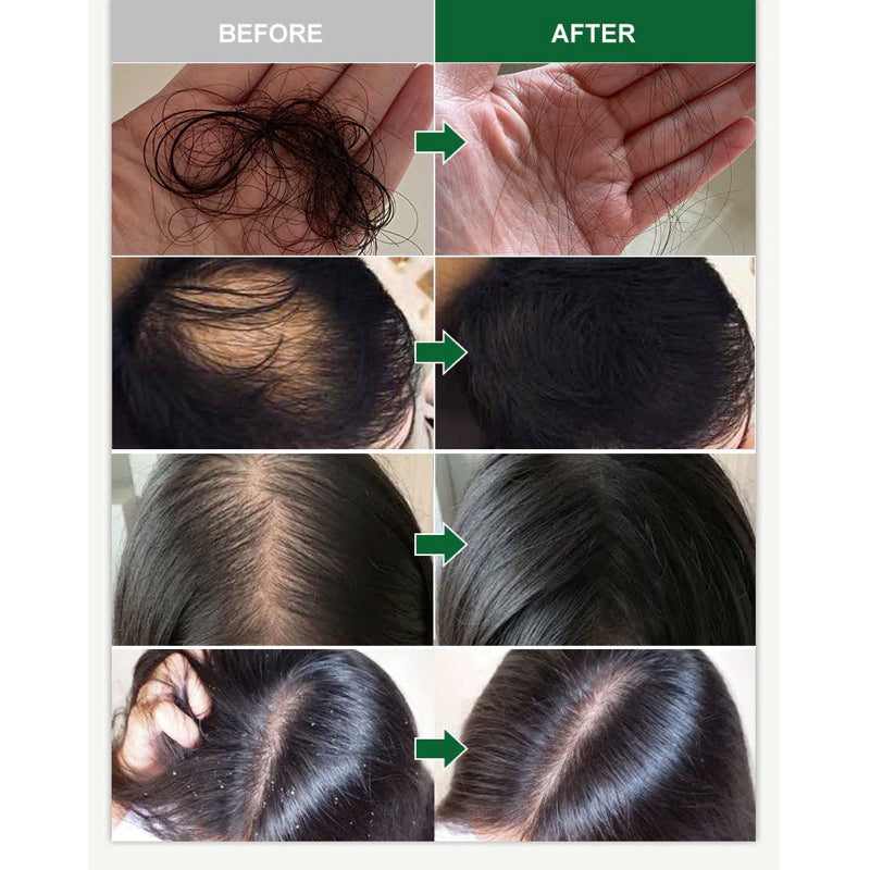 120ml Wiss Natural Rosemary Oil for Hair Scalp Care Promote Growth Hair Reduce Hair Loss Skin Care Hair Oil Body Oil
