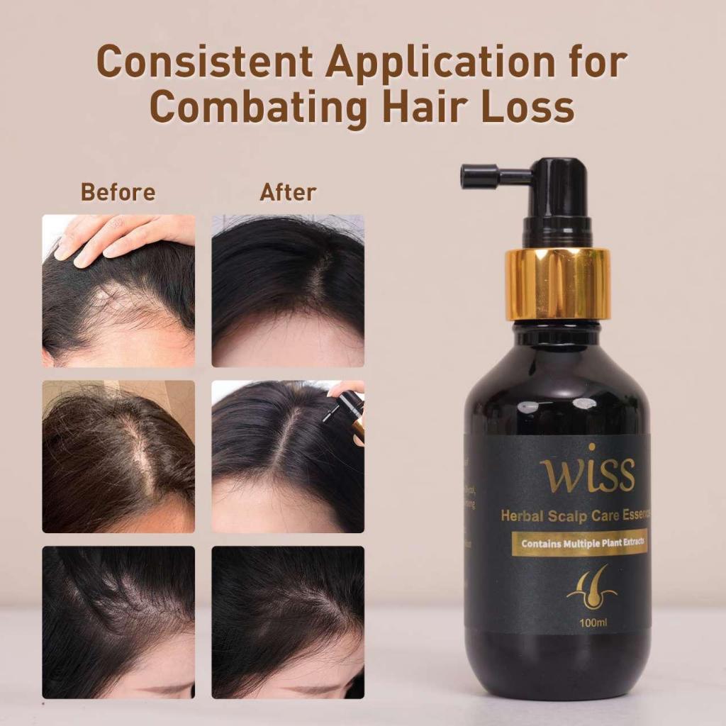 Wiss Herbal Scalp Care Essence Anti-Hairloss Hair Loss Hair Tonic/ Hair Thinning Solution 100ml SG Ready Stock