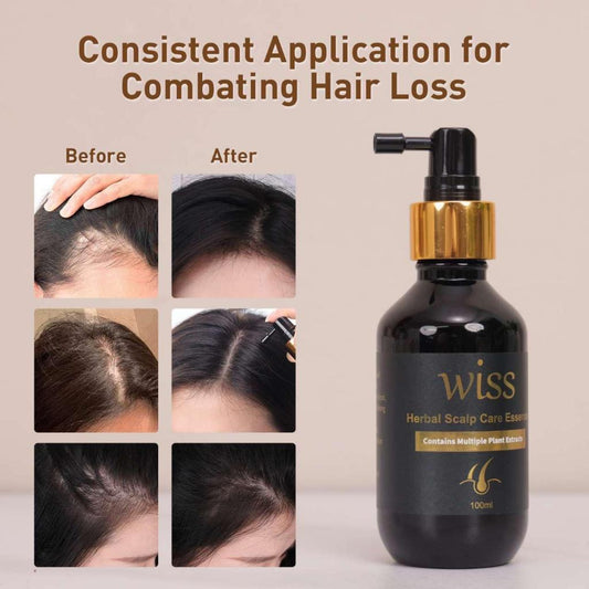 Wiss Herbal Scalp Care Essence Anti-Hairloss Hair Loss Hair Tonic/ Hair Thinning Solution 100ml SG Ready Stock